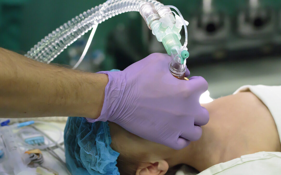 Top 5 Questions Patients Ask About Anesthesia — Answered